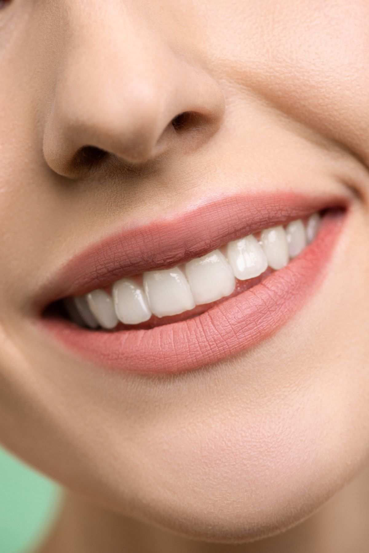 Smile result 2