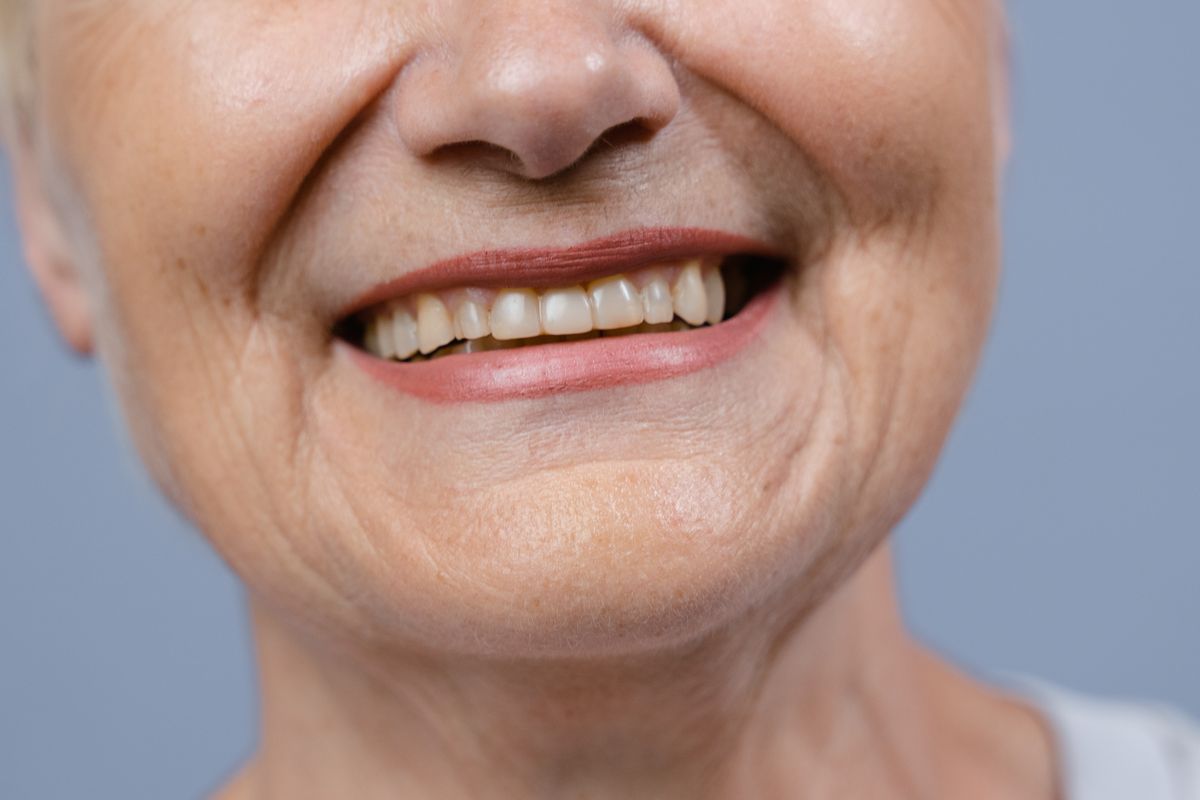 Smile result 3