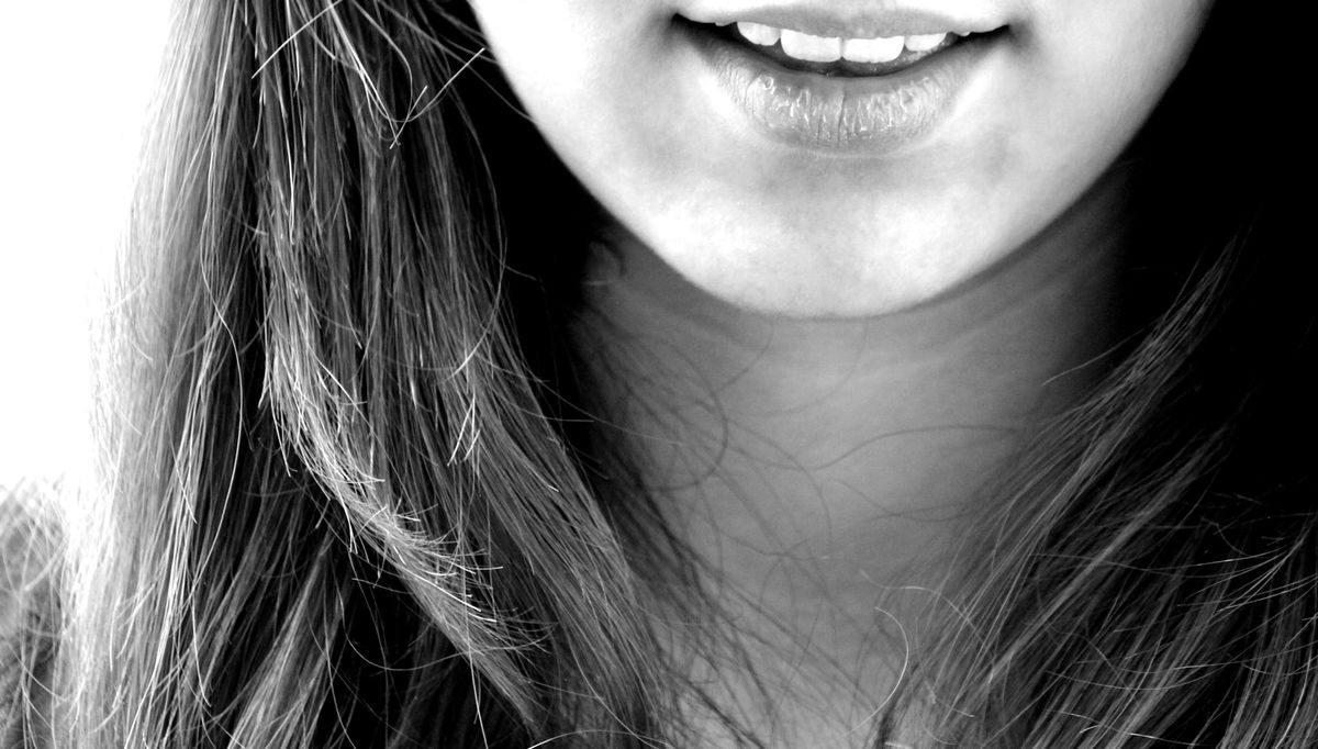 Smile result 6